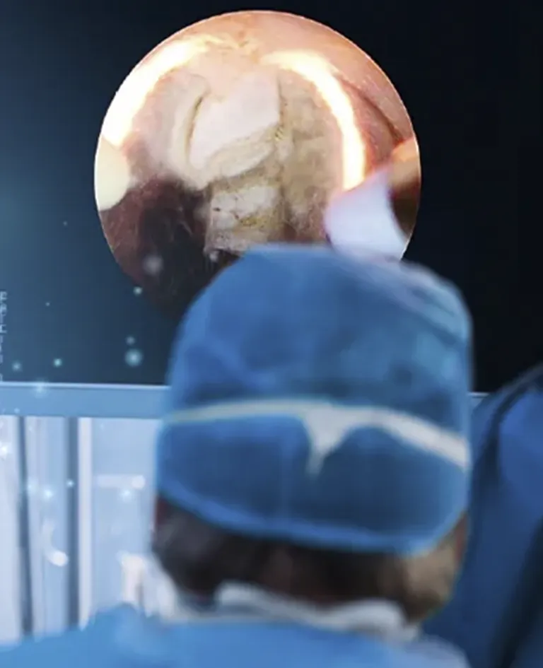 turis-plasma-martin-piana